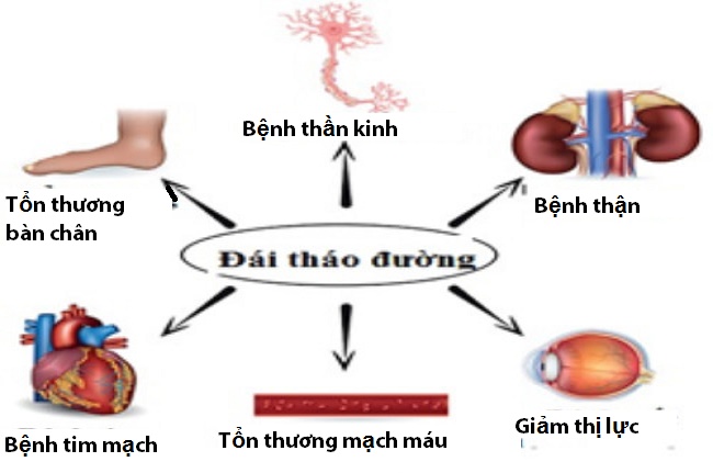 bệnh tiểu đường